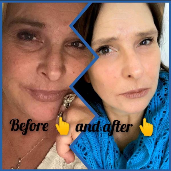 tanya fleiser ageLOC LumiSpa iO results