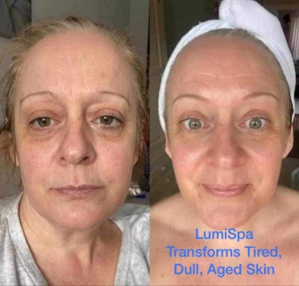 ageLOC LumiSpa iO results